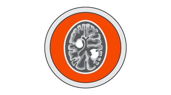 Illustration of a brain scan