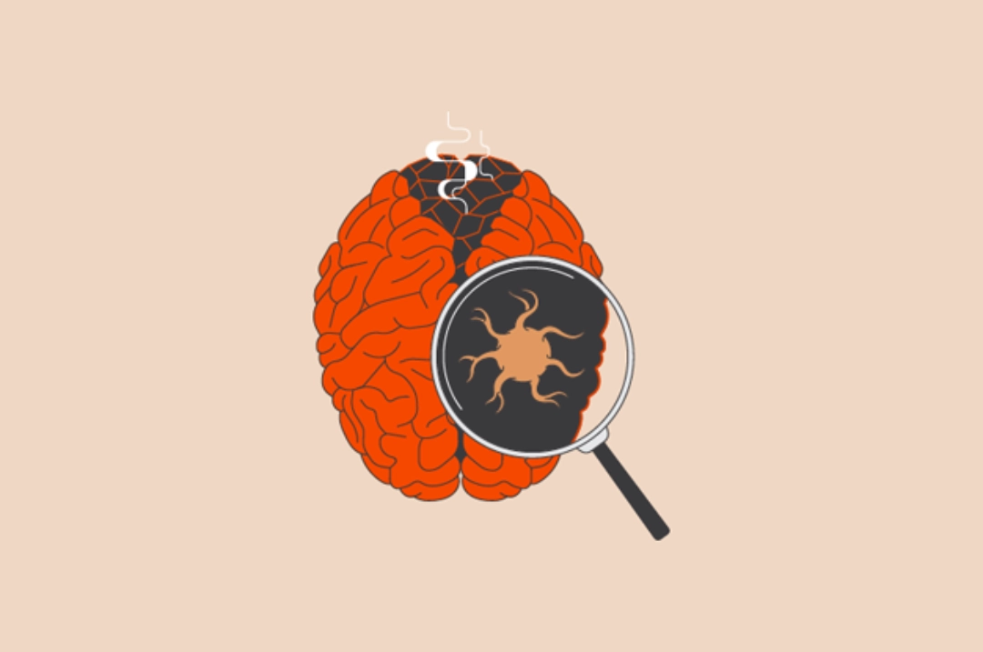 Illustration of a smoldering brain and a magnifying glass showing microglia in the brain