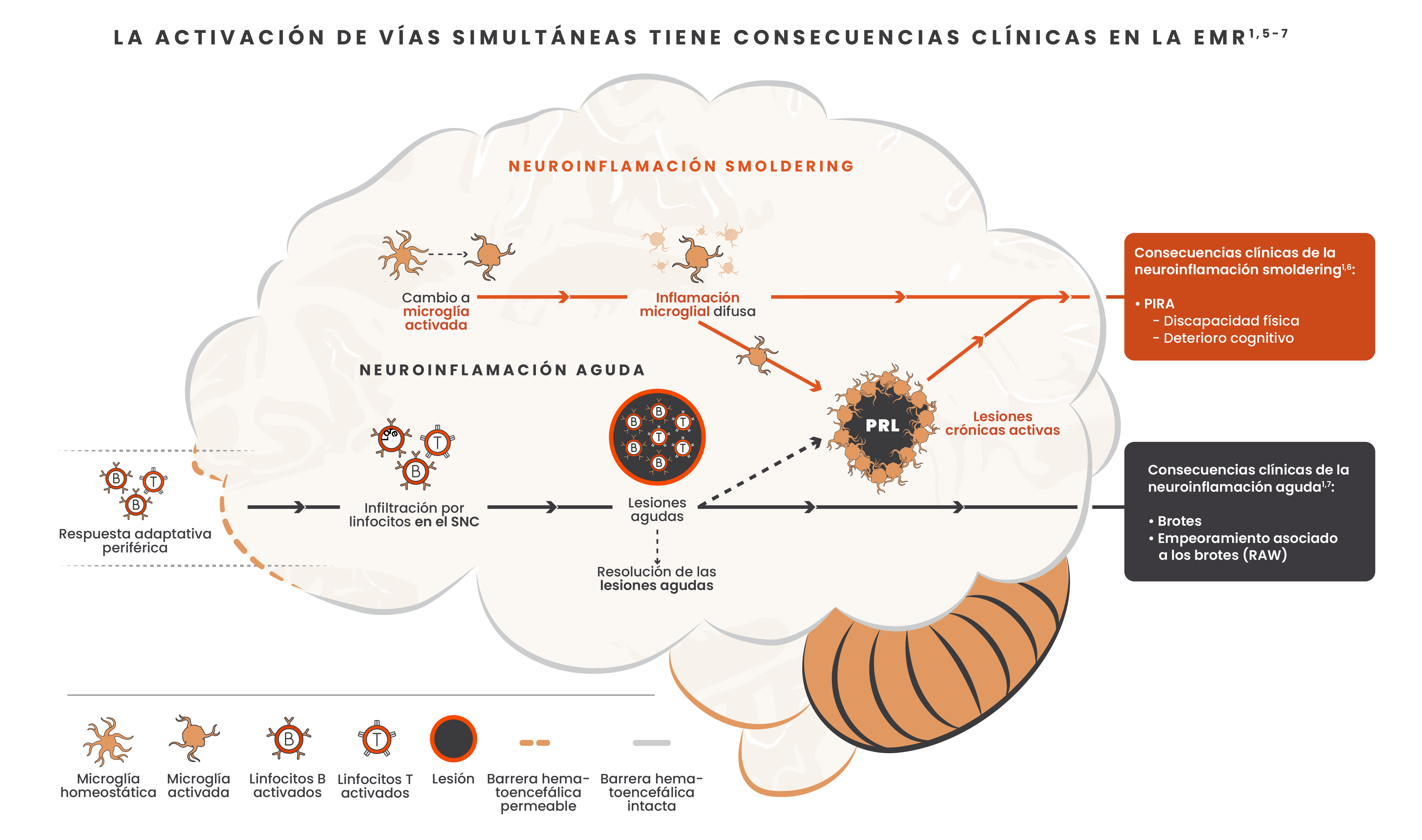 Imagen que muestra las vías confluentes de la neuroinflamación aguda y smoldering y los efectos de estas vías en el cerebro, junto con imágenes de la microglía, los linfocitos B, los linfocitos T, las lesiones y la barrera hematoencefálica.