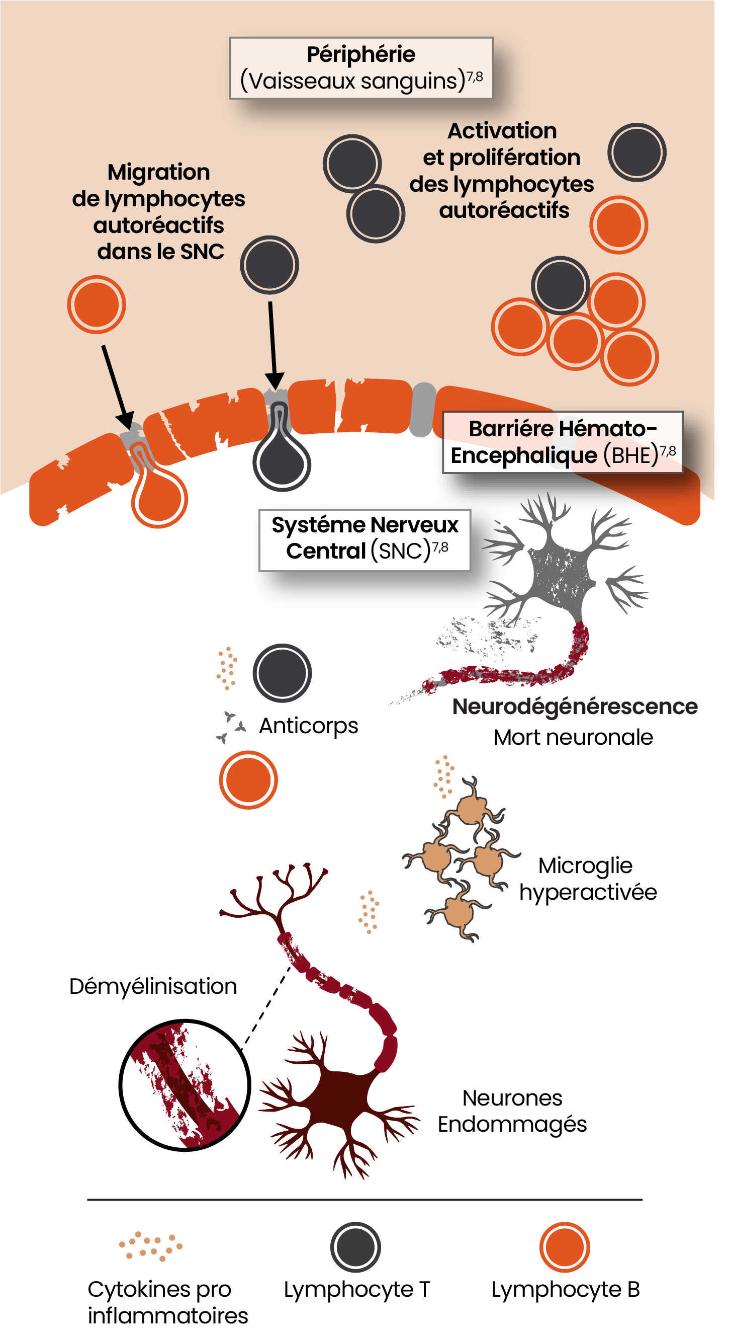 Illustration montrant la physiopathologie de la neuroinflammation aiguë et chronique