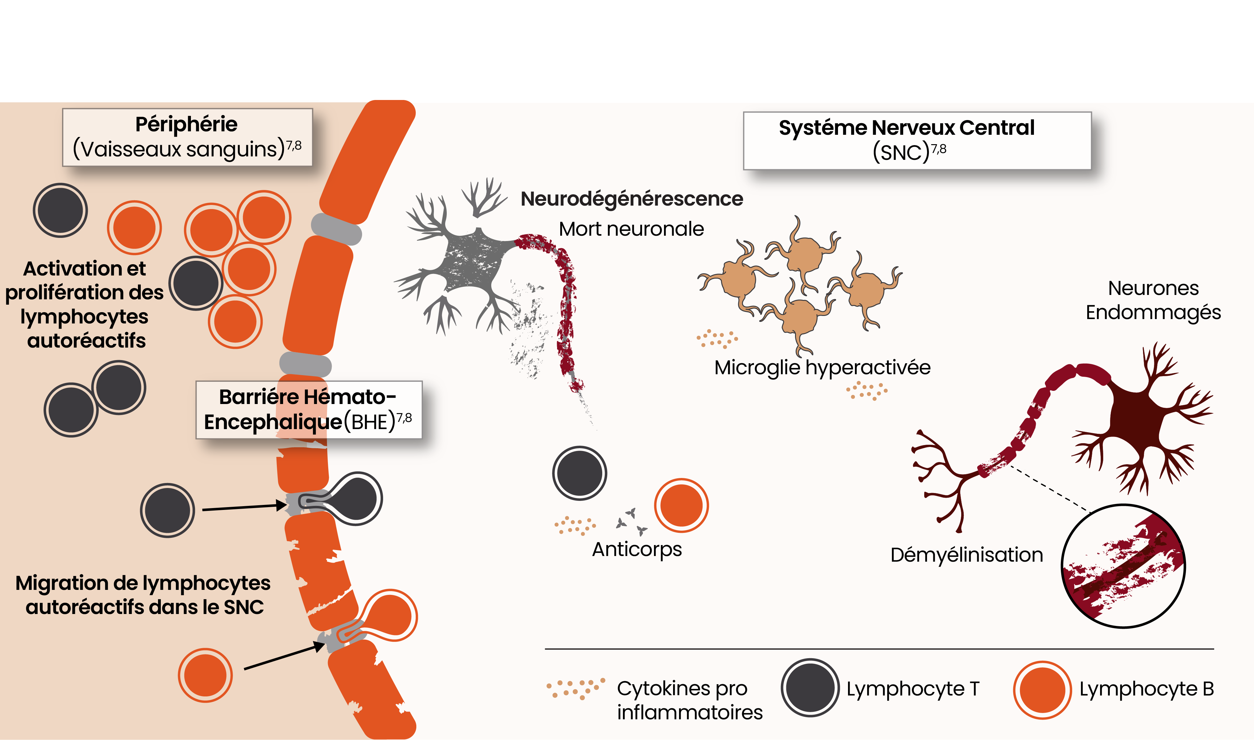 Illustration montrant la physiopathologie de la neuroinflammation aiguë et chronique