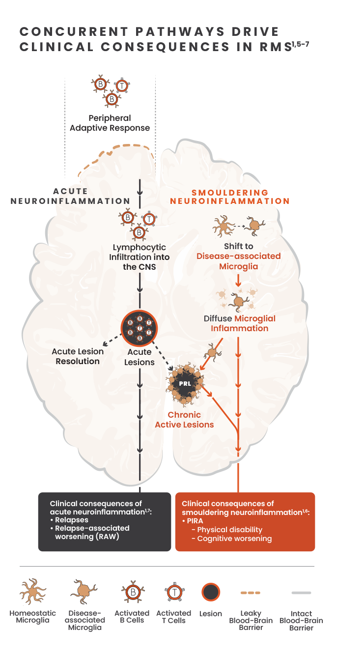 Illustration showing concurrent pathways of acute and smoldering neuroinflammation and the effects of these pathways in the brain with images of microglia, b-cells, t-cells, lesions and the blood brain barrier.