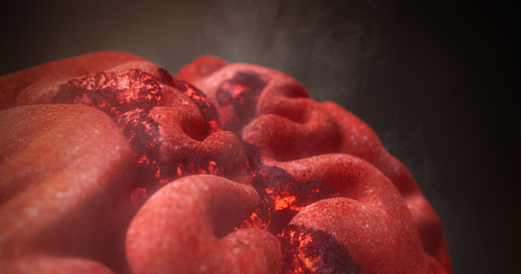 smoldering-brain-image-og.2025-05-06-15-19-51.png