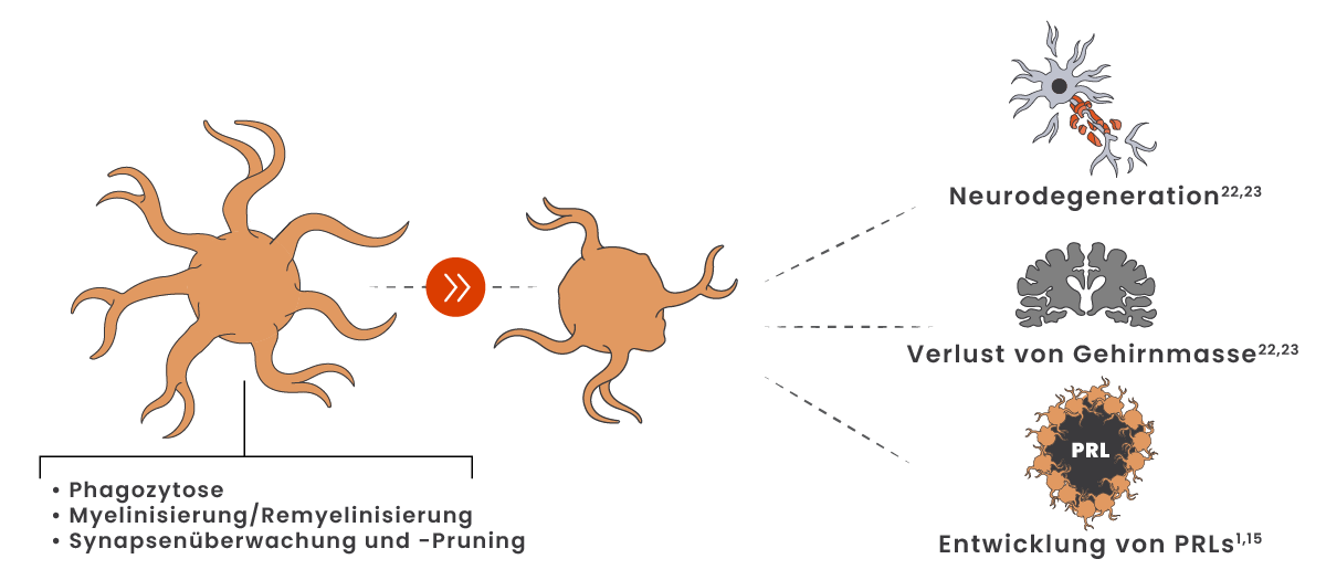 Illustration des Shifts der Mikroglia von einem homöostatischen in einen krankheitsassoziierten Zustand