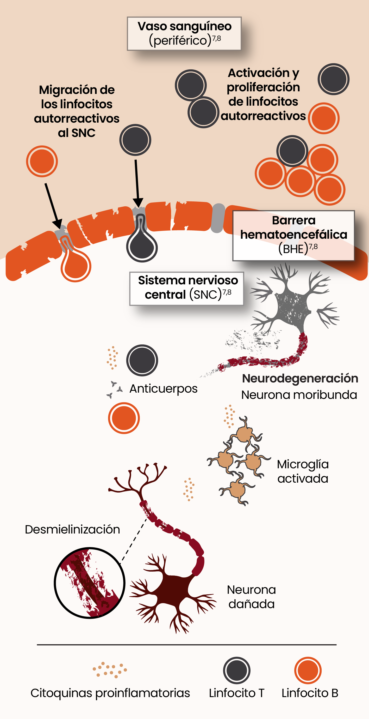 Illustration showing the pathophysiology of acute and smoldering neuroinflammation