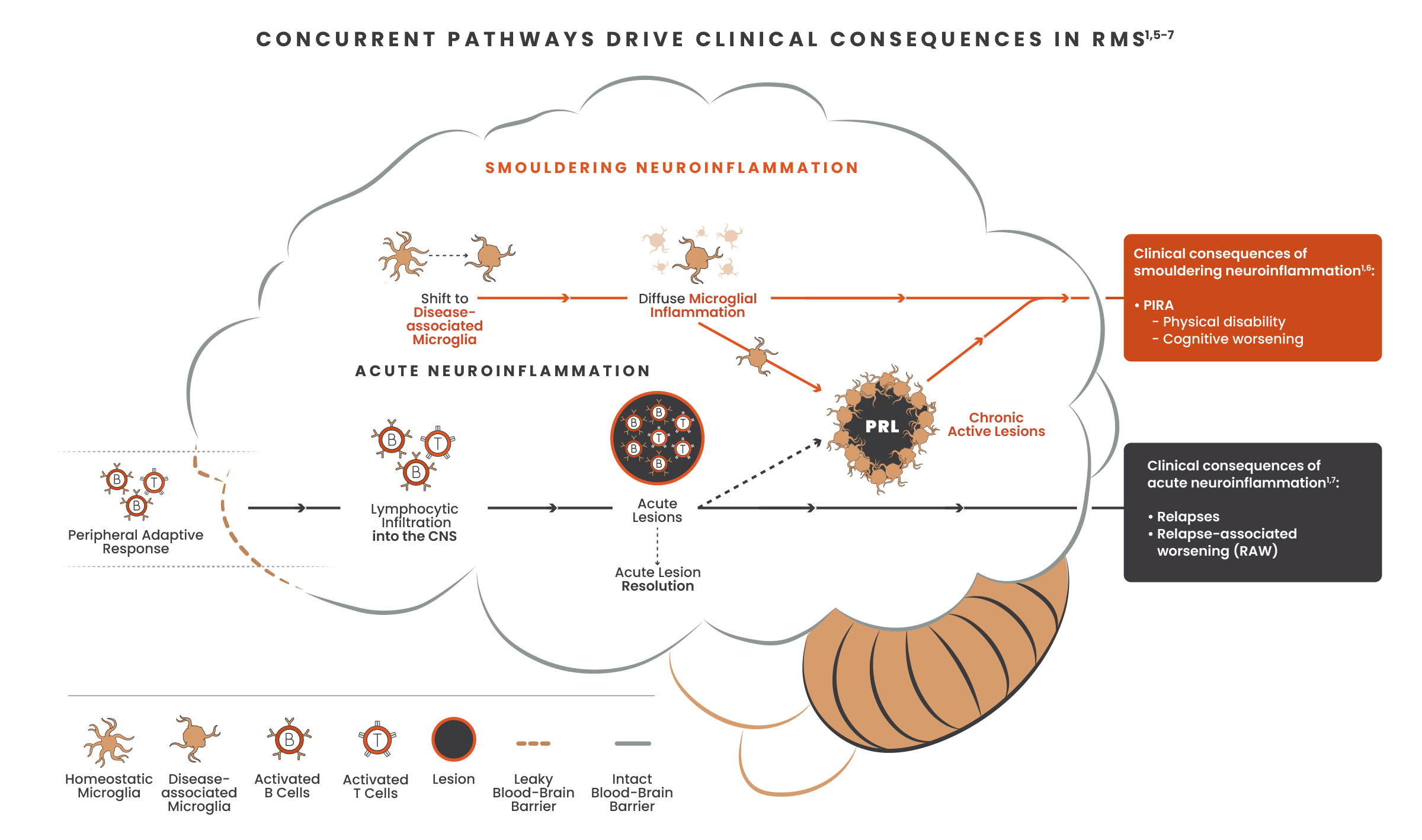 Illustration showing concurrent pathways of acute and smoldering neuroinflammation and the effects of these pathways in the brain with images of microglia, b-cells, t-cells, lesions and the blood brain barrier.