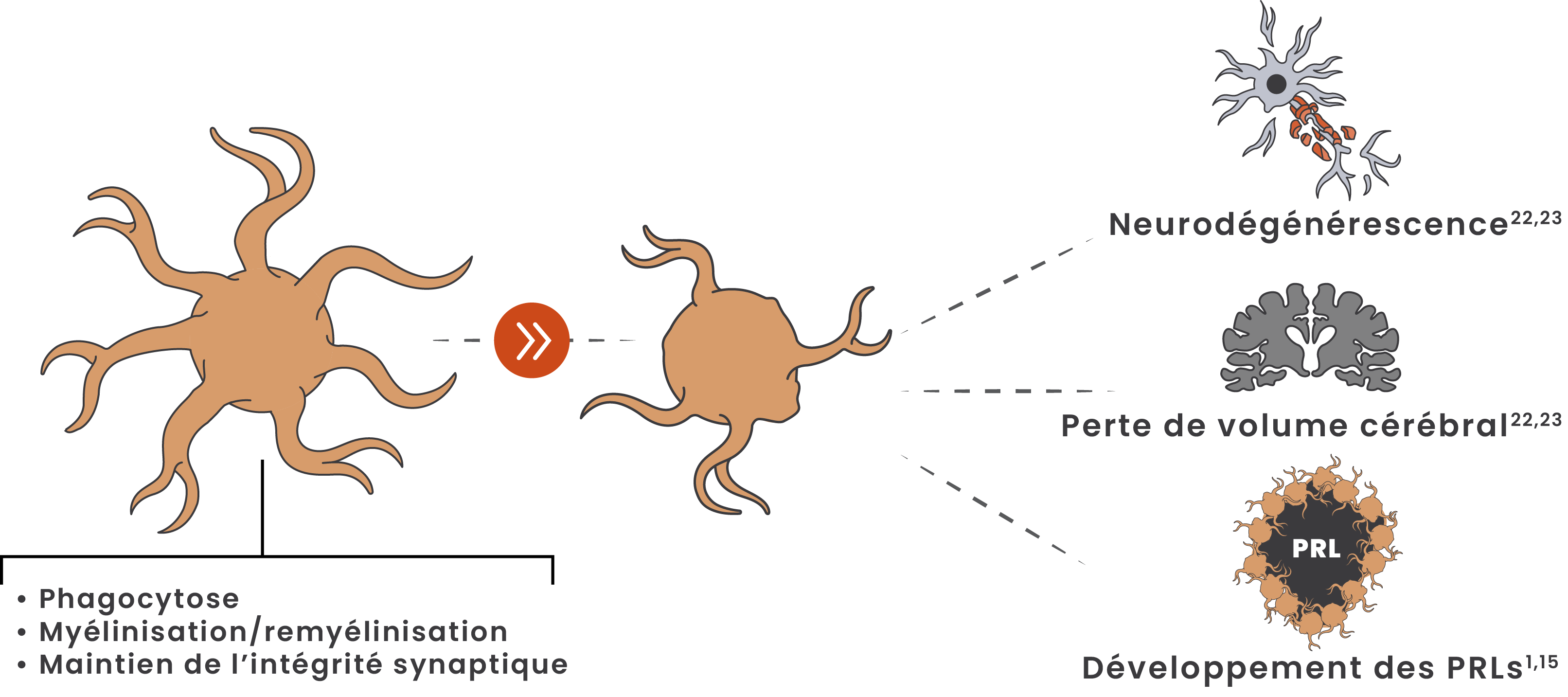Illustration montrant le passage des microglies d'un état homéostatique à son état pathogénique